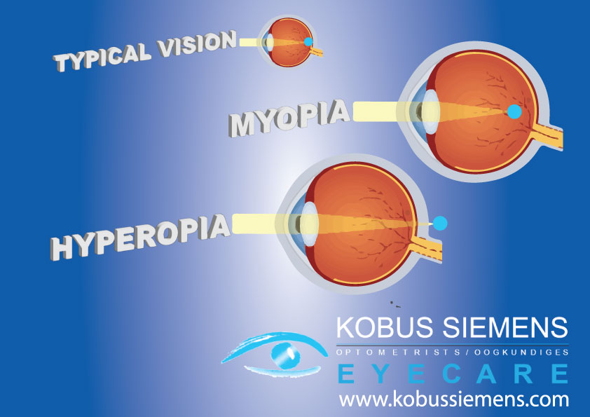 MYOPIA